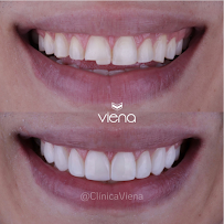 Clínica Viena / Veneers Medellín