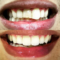 Happy Mouth Dental Clinic
