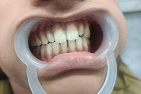 Mitrasen Dental & Health Clinic (Dr. Mitesh N. Jain)