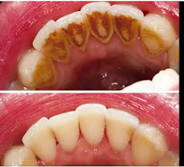 Jaya Lakshmi Dental Clinic (Charitable)