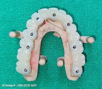 Jayshree Advanced Dental Clinic & Implant Centre Dr Pravin Dange