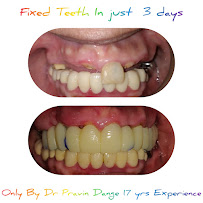 Jayshree Advanced Dental Clinic & Implant Centre Dr Pravin Dange