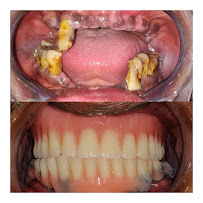 Jayshree Advanced Dental Clinic & Implant Centre Dr Pravin Dange