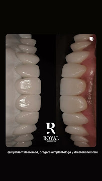 Royal Dental Care