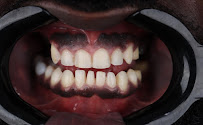 Royal Dental Care