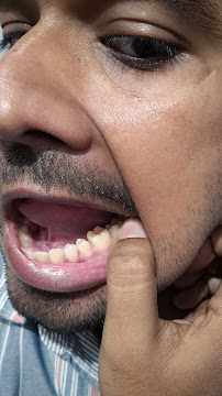 Apollo Dental Clinic