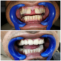 32 WHITES DENTAL