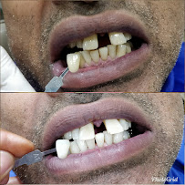 32 WHITES DENTAL