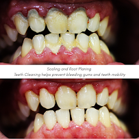 Dental Clinic Near Me (Mint Dental Clinic - Dental Implant/Kids Dental Clinic/Aligners(Braces)Dadar West
