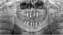 Dentalisa Clinic Ağız ve Diş Sağlığı Polikliniği