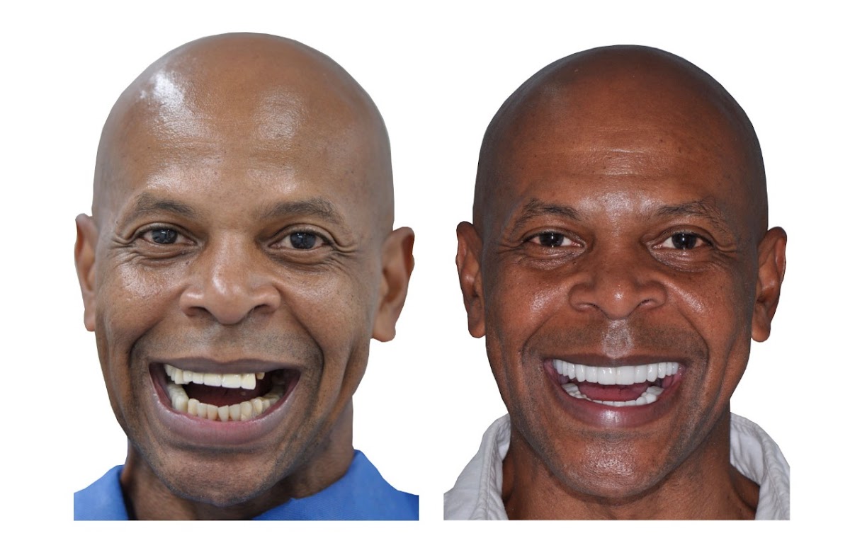 Dental Tourism Colombia (Dr. Johana Ossa, Medellin) - dental clinic in Medellin, Colombia