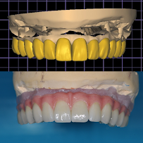 Dental Tourism Colombia (Dr. Johana Ossa, Medellin)