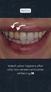 Dental Tourism Colombia (Dr. Johana Ossa, Medellin)