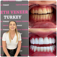 Tunç Dent Ağız ve Diş Sağlığı Polikliniği (Teeth Veneers Turkey)