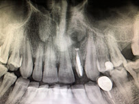 Prof. Dr. Sinan TOZOĞLU - Ağız, Diş ve Çene Cerrahı