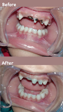 Mikael Dental