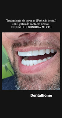 Clínica Dental Home
