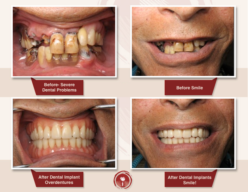 Sai Dental and Implant Clinic
