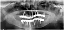 Sai Dental & Implant Clinic