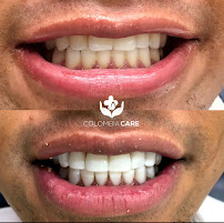 Colombia Care Dental
