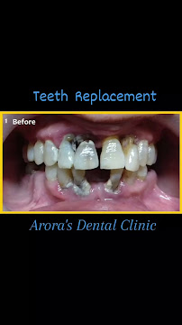 Arora's Dental Studio : Dental Clinic in Ashok Vihar (Dentist in Ashok Vihar, Delhi)