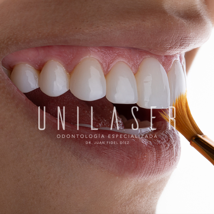 Clinica Unilaser - dental clinic in Medellin, Colombia