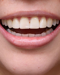 ORAL CONCEPT INVISALIGN