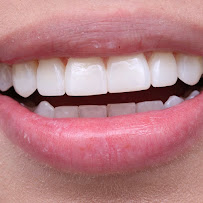 ORAL CONCEPT INVISALIGN