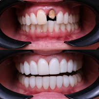 ORAL CONCEPT INVISALIGN