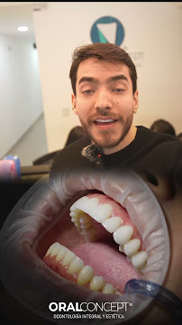 ORAL CONCEPT INVISALIGN