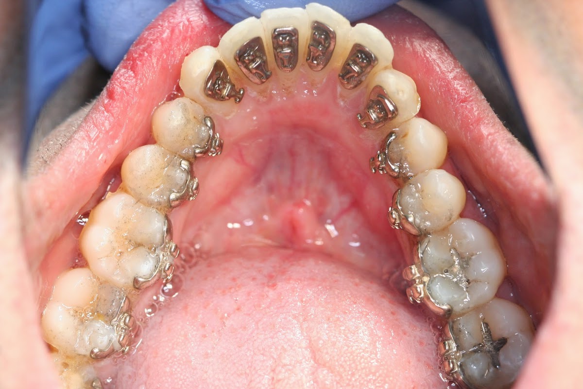 Teeth N Braces Dental Orthodontic Clinic