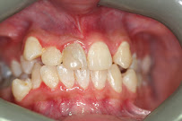 Teeth N Braces - Dental Orthodontic Clinic in Punjabi Bagh, Delhi