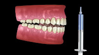 Braces and Crowns