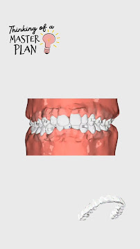 Braces and Crowns