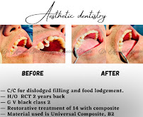 OrthoSquare Dental Clinic - East Patel Nagar, New delhi