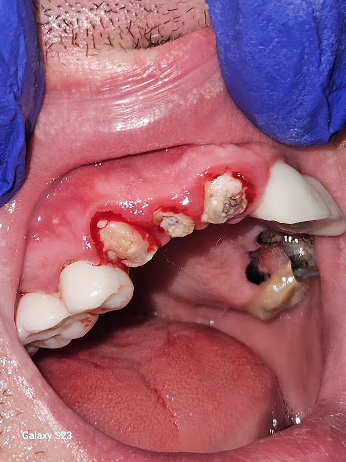 Smile Dental Care