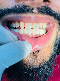 Smile dental care