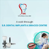 S.R. DENTAL IMPLANTS & BRACES CENTRE