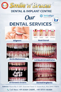 Smile n Braces Dental Clinic - Invisalign, Implants, Veneers