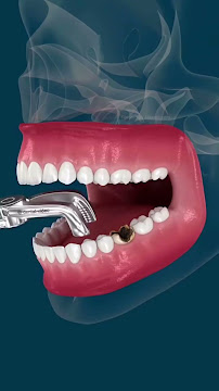Smile n Braces Dental Clinic - Invisalign, Implants, Veneers