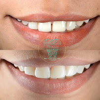 Meraki Dental Studio - Best Dentist in Delhi India