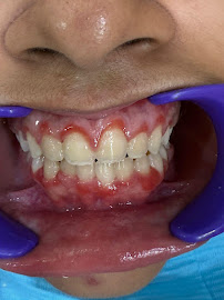 Clove Dental Clinic in Prashant Vihar, Delhi