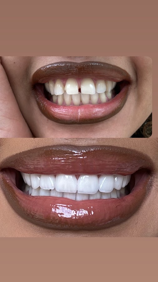 Top Smiles - dental clinic in Medellin, Colombia