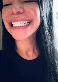 Top Smiles