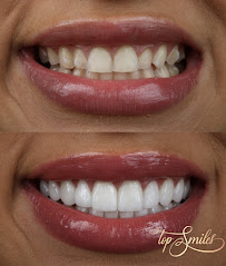 Top Smiles