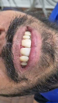 DNS Dental Care - Implant & Orthodontic Centre