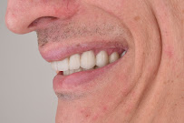OZAK DENTAL CLINIC - OZAK Ağız ve Diş Sağlığı Polikliniği Antalya