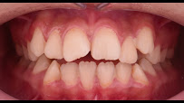 OZAK DENTAL CLINIC - OZAK Ağız ve Diş Sağlığı Polikliniği Antalya
