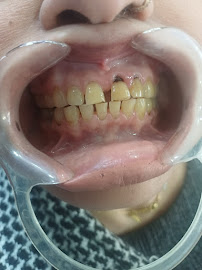 IMPLANT AND SURGERYCENTRE ( ON CGHS PANEL )