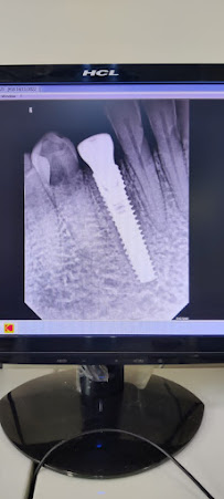 Delhi Dental Implant Center